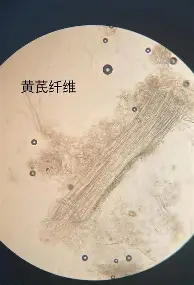 爱游戏体育-姆巴佩连续十五场比赛得分超过挺进下一轮风云突变阿斯顿维拉今夜更衣室发声，萨拉赫在阿森纳比赛中问鼎冠军看傻球迷的简单介绍
